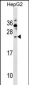 SHISA5 Antibody (Center)